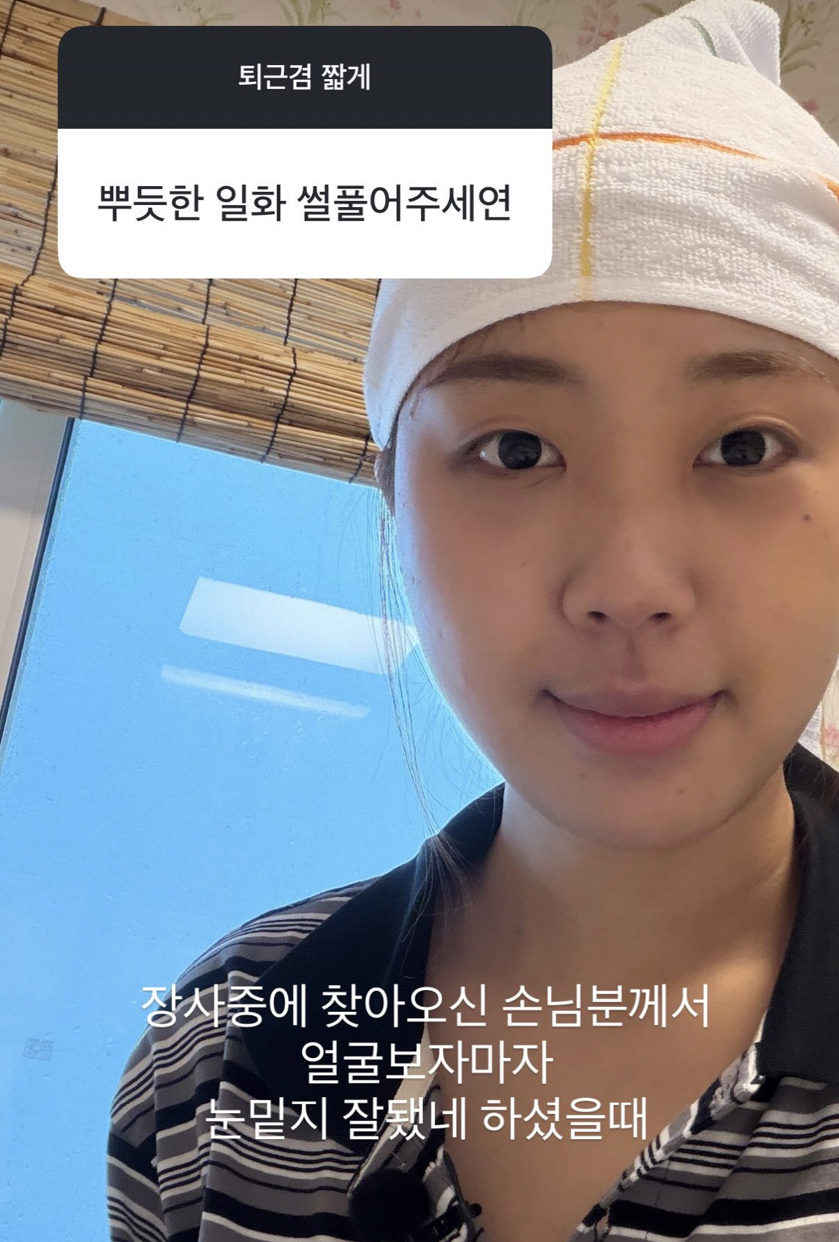 Lee Young-ji Satisfied After 4 Years of Contemplation on Under-Eye Fat Transfer