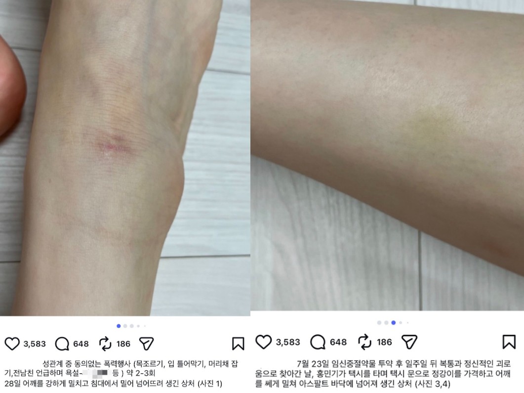 Hong Min-gi Dating Violence Dispute Heads to Court as Both Sides Announce Legal Action