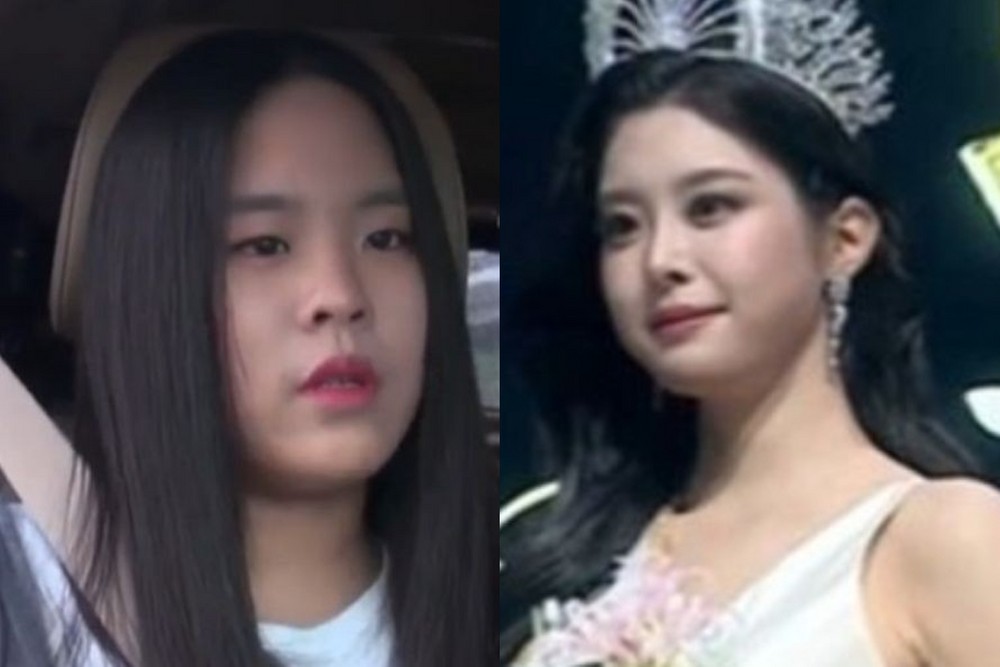 Miss Korea 2026 Winner Woo Seo-yun Claps Back at Surgery Rumors With Unedited Stage Footage