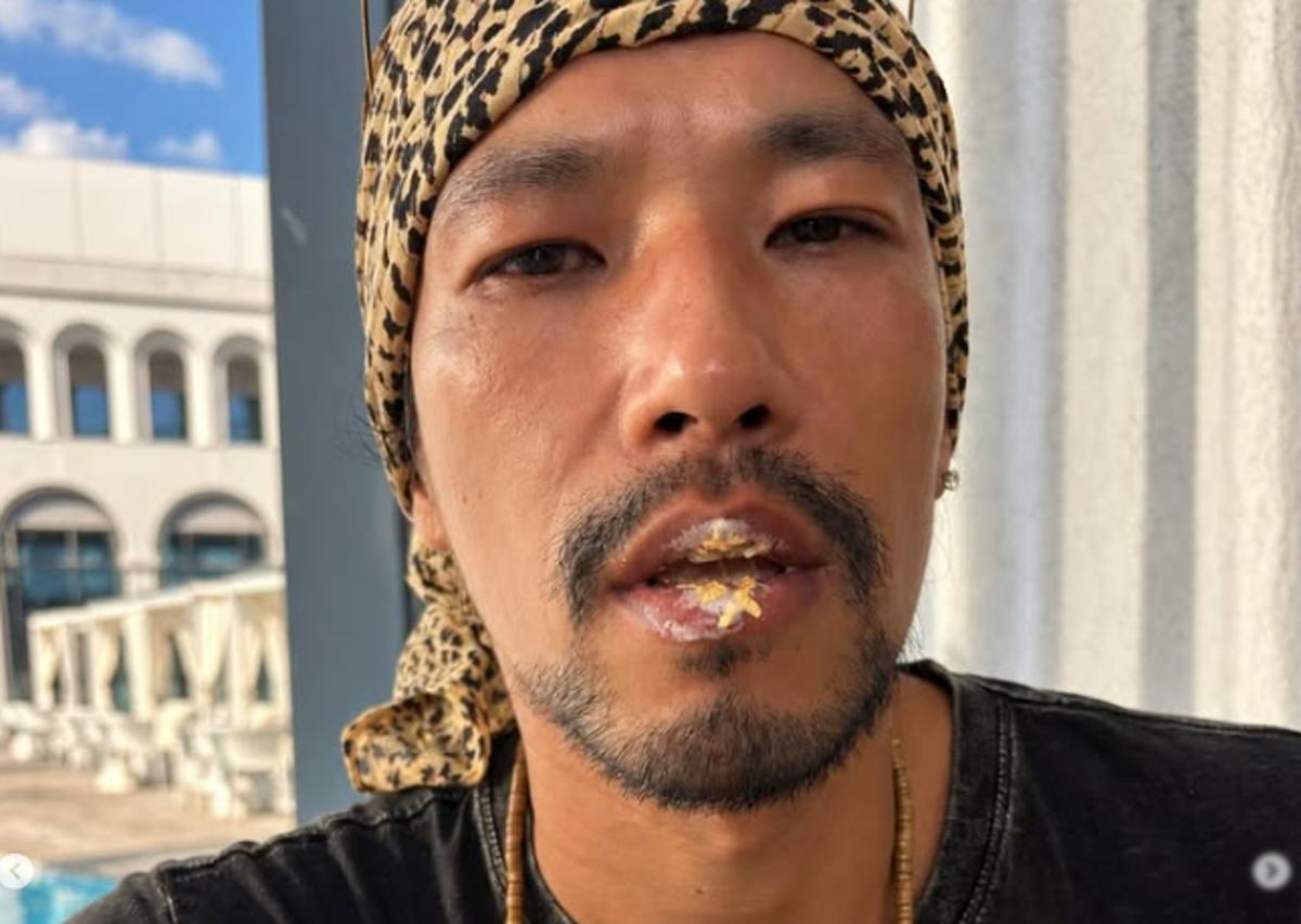 Kim Min's 90-Year-Old Fixer-Upper Is the Ratings Cure I Live Alone Needs