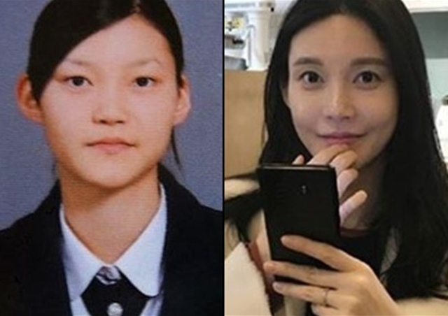 Cha Ye-ryun Denied the Bullying Claim in 1 Day. Then Came the Deleted Comments Row